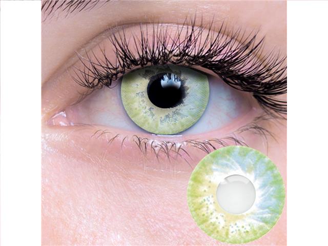Lentilles cornéennes Été
